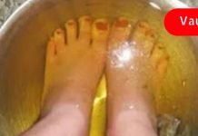 თუ ფეხებს ვაშლის ძმარში ჩააწყობთ, სამუდამოდ დაივიწყებთ ფეხის სოკოსა და უსიამოვნო სუნს!