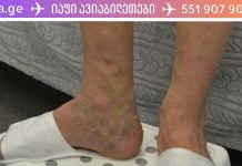 ეს ბალზამი საუკეთესო საშუალებაა სისხლძარღვთა ქსელის მოსაშორებლად და კანის სილამაზის აღდგენისთვის!