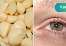 როგორ აღვადგინოთ მხედველობა ნიორით. არანაირი ოპერაციები!