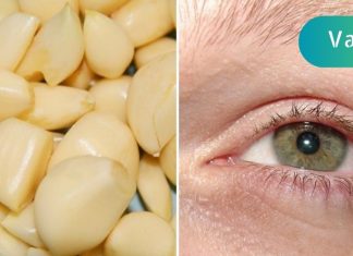 როგორ აღვადგინოთ მხედველობა ნიორით. არანაირი ოპერაციები!