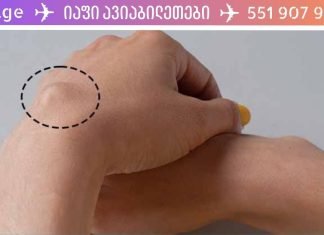 მოიცილეთ ლიპომები ამ ბუნებრივი რეცეპტის დახმარებით! სულ რაღაც 1 კირაში დაემშვიდობებით მას!
