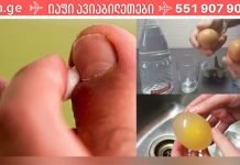 მოიშორეთ ფეხის სოკო ძმრისა და კვერცხის გამოყენებით… ის ბევრს გამოადგა უკვე..