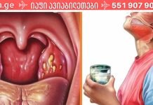 როგორ მოვიშოროთ ყელის ტკივილი სულ რამდენიმე საათში!!! შვებას სულ რაღაც ორ საათში იგრძნობთ!.
