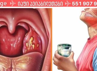 როგორ მოვიშოროთ ყელის ტკივილი სულ რამდენიმე საათში!!! შვებას სულ რაღაც ორ საათში იგრძნობთ!.